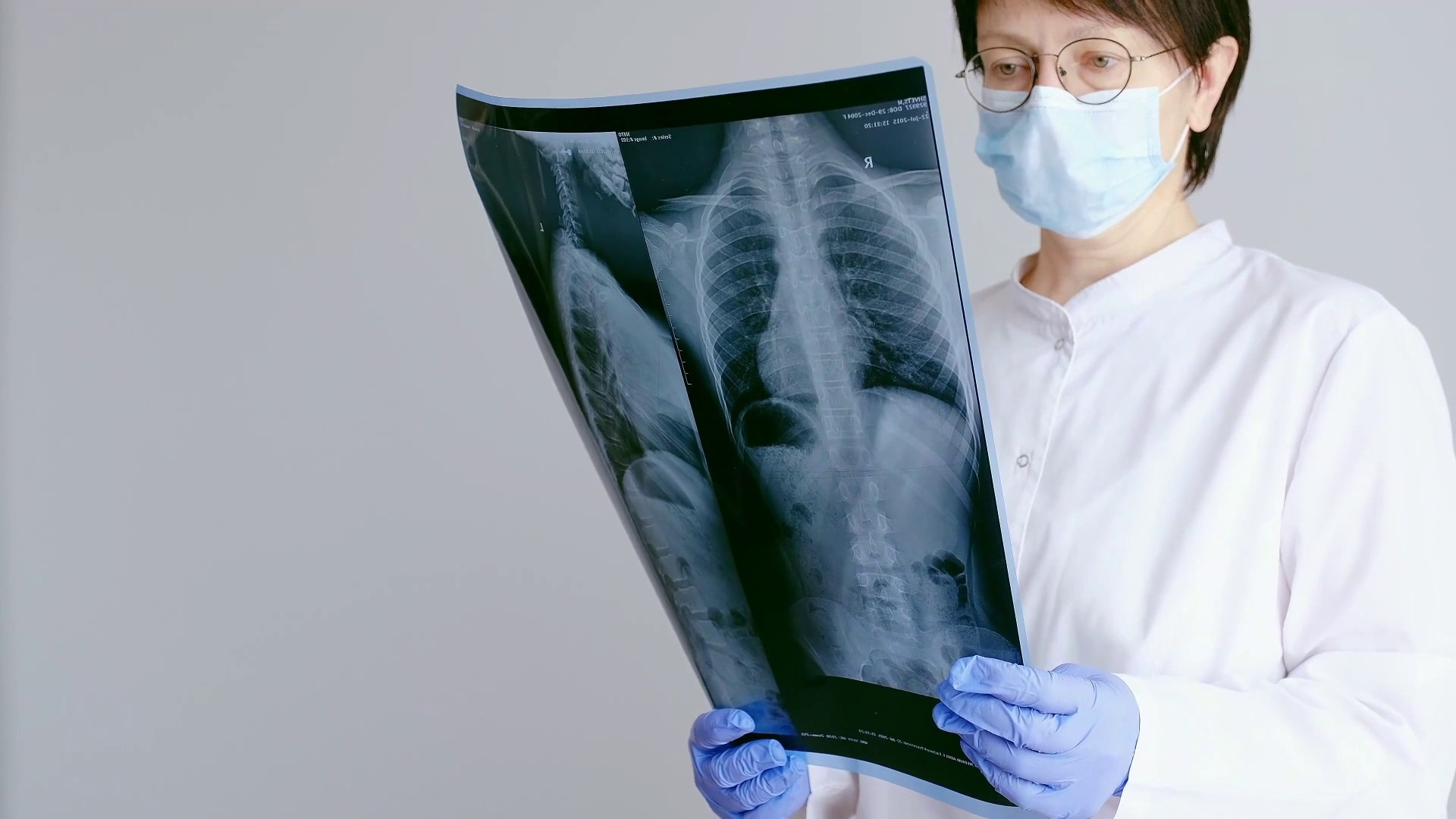 Il Covid ha cambiato percezione malattie respiratorie, nuova attenzione a rischi