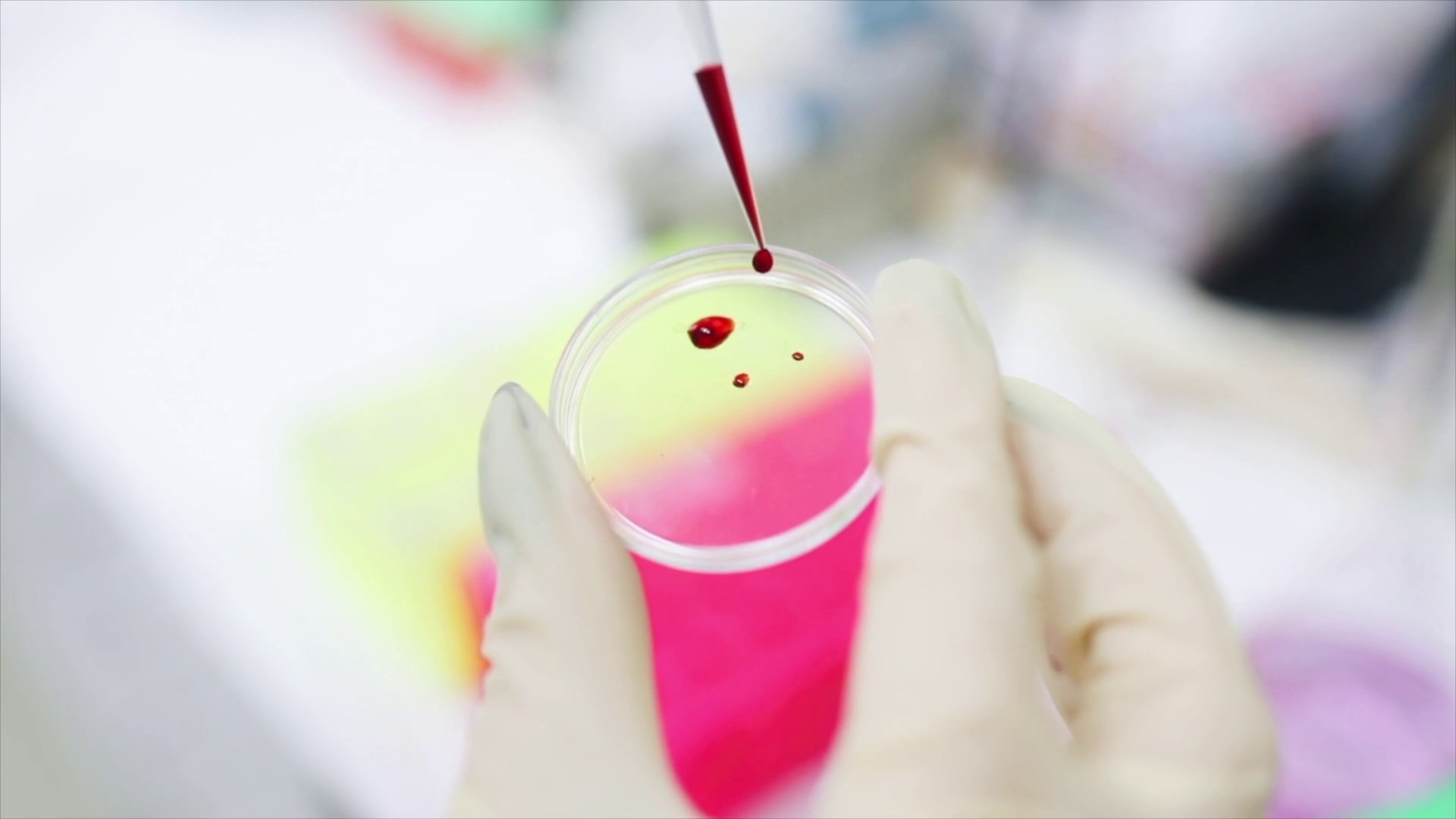 HIV, nuove conferme su terapie e profilassi long-acting