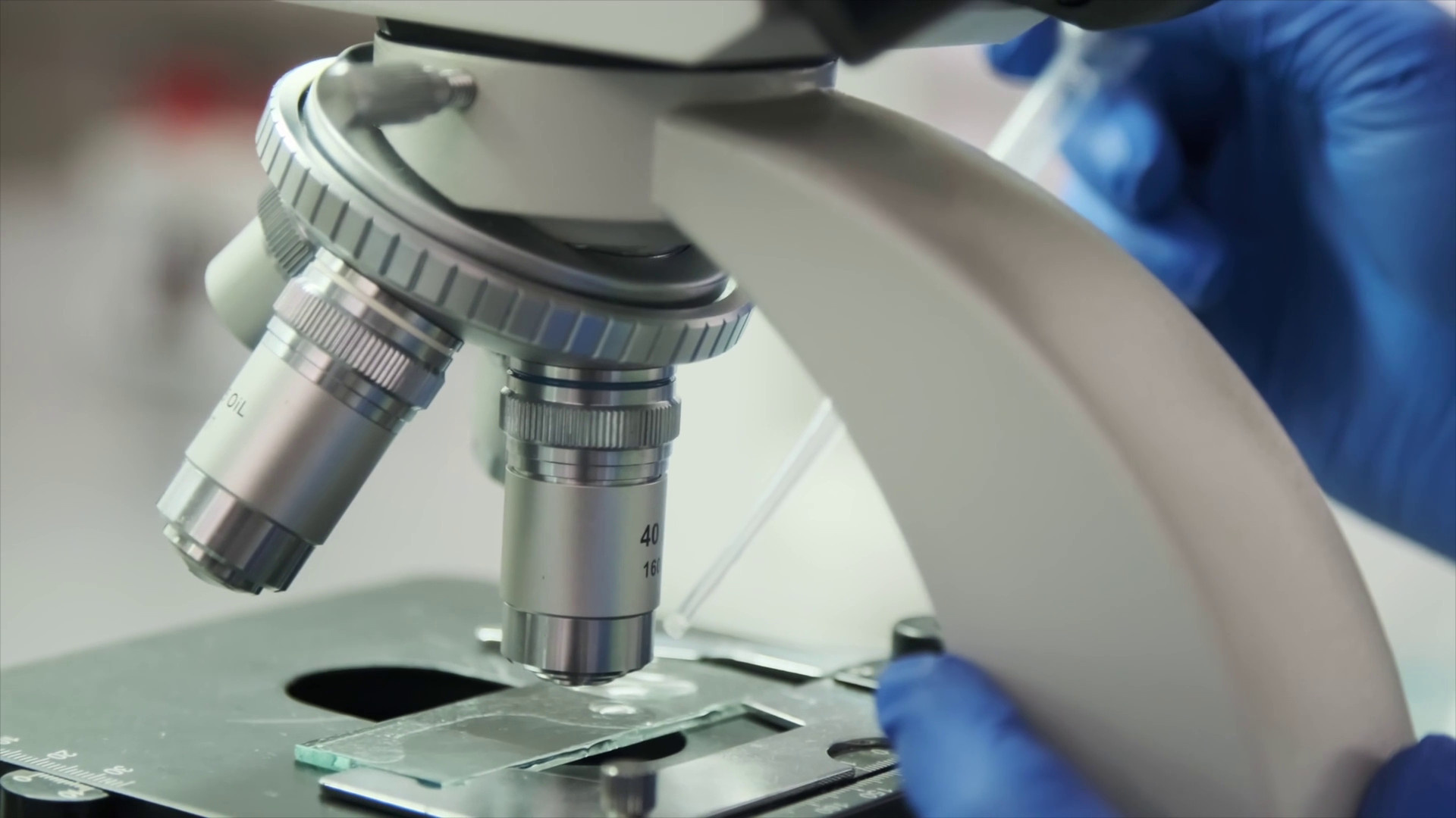 HIV, nuove conferme su terapie e profilassi long-acting