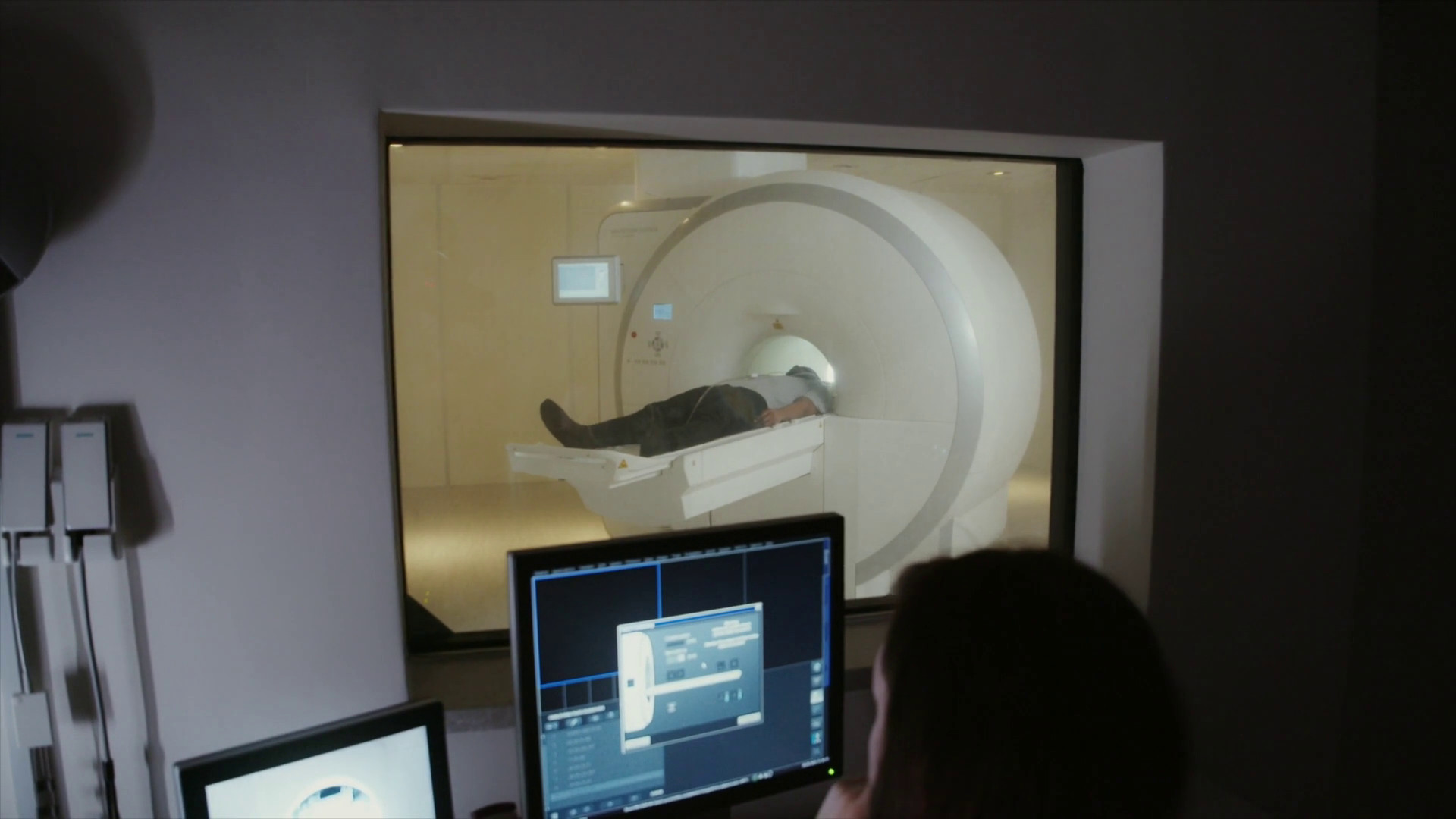 Neurochirurgia, sempre più interventi con paziente sveglio