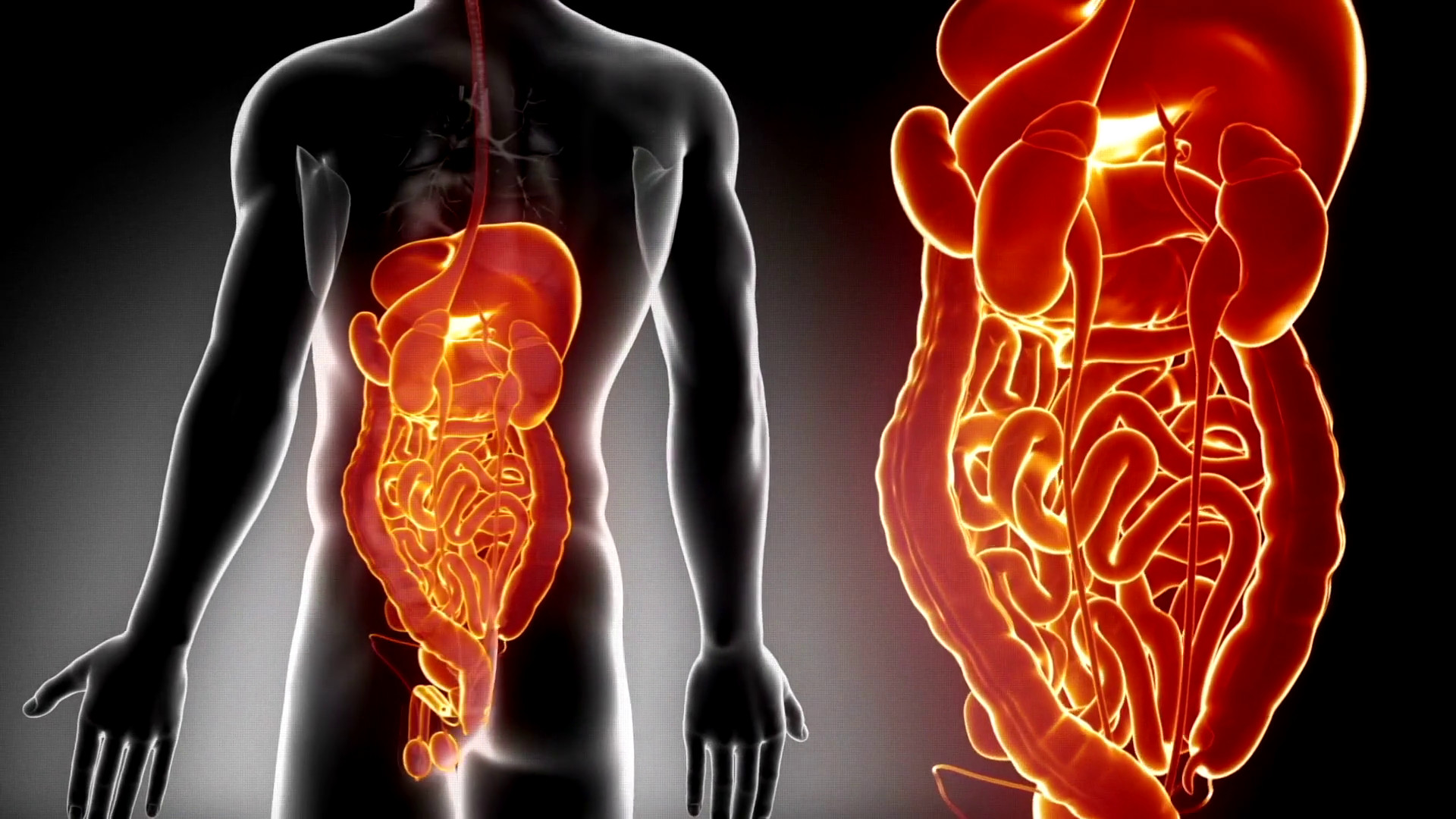 Cresce l'incidenza delle malattie infiammatorie croniche intestinali